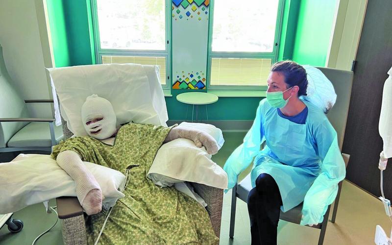 Submitted Photo Barrett McKim, 12, sustained burns to 50 percent of his body after an science experiment exploded, Thursday, June 23. His mother, Caroline McKim was also burned after trying to put out the flames.