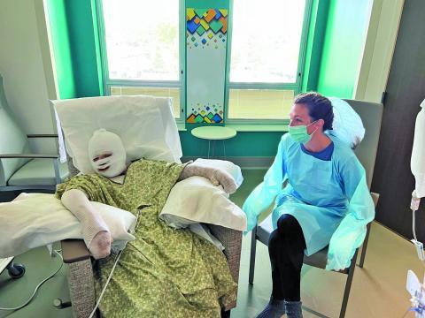 Submitted Photo Barrett McKim, 12, sustained burns to 50 percent of his body after an science experiment exploded, Thursday, June 23. His mother, Caroline McKim was also burned after trying to put out the flames. 
